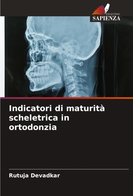 Indicatori di maturità scheletrica in ortodonzia - Rutuja Devadkar