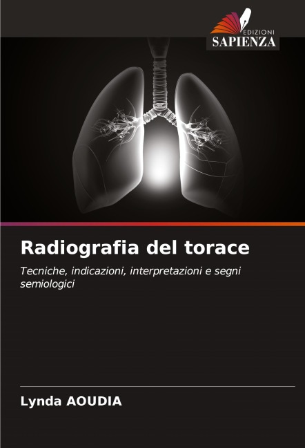 Radiografia del torace - Lynda Aoudia