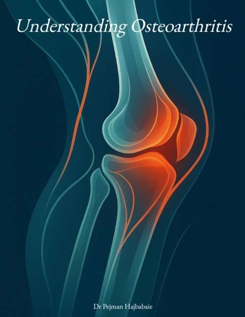 Understanding Osteoarthritis (2nd Edition) - Pejman Hajbabaie