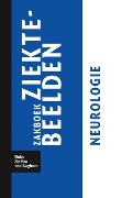 Cover-Bild zum Titel 'Zakboek Ziektebeelden Neurologie' von 'Karin Linden'
