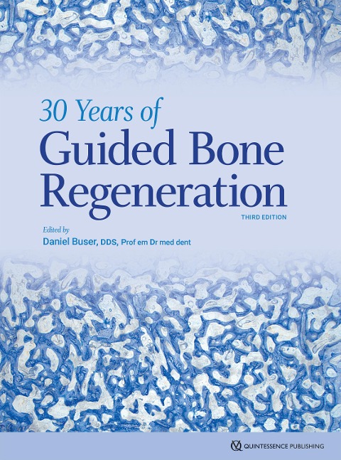 30 Years of Guided Bone Regeneration - Daniel Buser