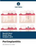 Cover-Bild zum Titel 'Periimplantitis' von 'Navnit Kaur, Harjit Kaur, Sanjeev Jain'