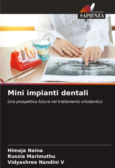 Mini impianti dentali - Himaja Naina, Russia Marimuthu, Vidyashree Nandini V