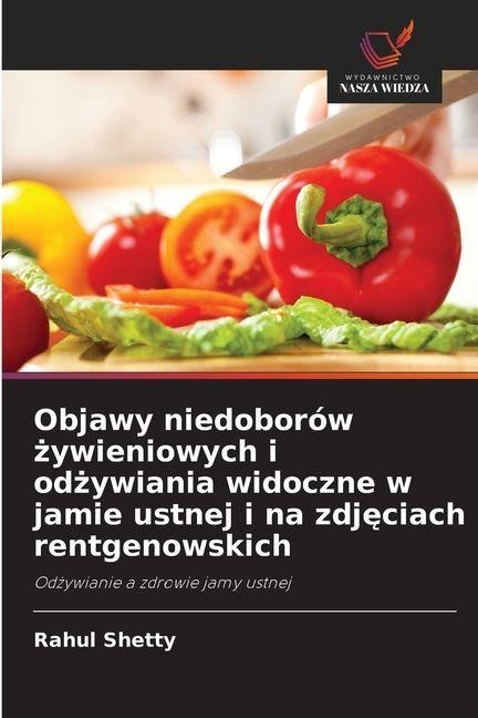 Objawy niedoborów ¿ywieniowych i od¿ywiania widoczne w jamie ustnej i na zdj¿ciach rentgenowskich - Rahul Shetty