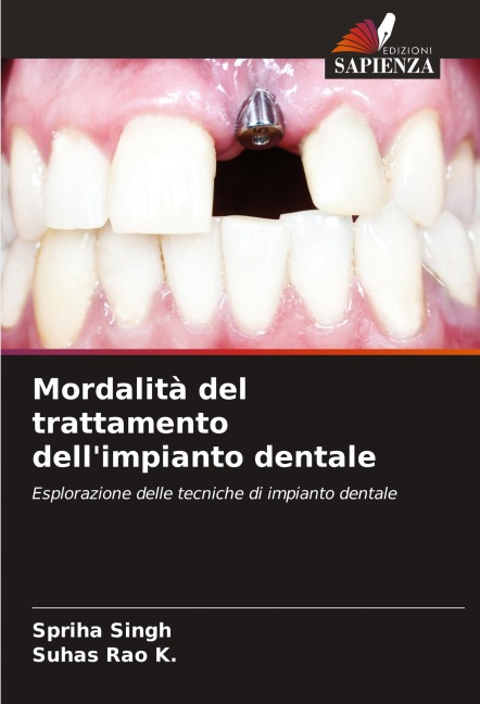 Mordalità del trattamento dell'impianto dentale - Spriha Singh, Suhas Rao K.