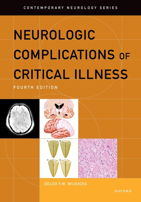 Neurologic Complications of Critical Illness - Eelco F. M. Wijdicks