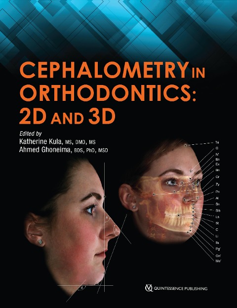 Cephalometry in Orthodontics - Katherine Kula, Ahmed Ghoneima