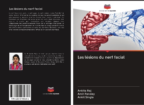 Les lésions du nerf facial - Ankita Raj, Amit Pandey, Ankit Singla