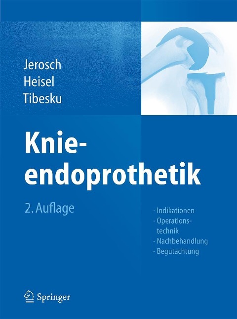 Knieendoprothetik - Jörg Jerosch, Jürgen Heisel, Carsten O. Tibesku