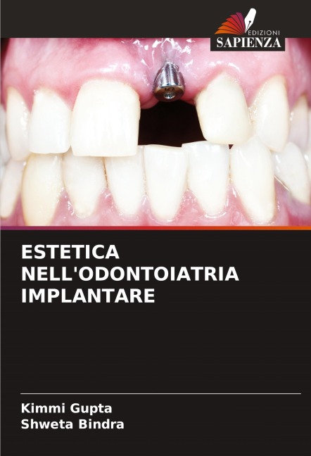 ESTETICA NELL'ODONTOIATRIA IMPLANTARE - Kimmi Gupta, Shweta Bindra