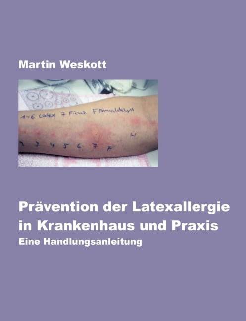 Prävention der Latexallergie in Krankenhaus und Praxis - Martin Weskott