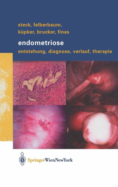 Endometriose - Thomas Steck, Ricardo E. Felberbaum, Wolfgang Küpker, Cosima Brucker, Dominique F. Finas