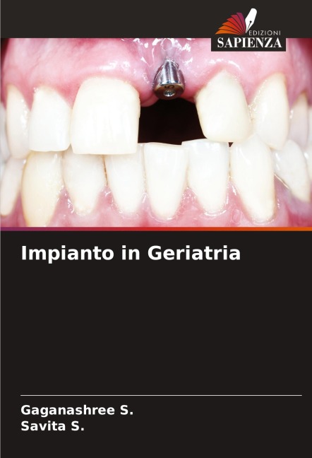 Impianto in Geriatria - Gaganashree S., Savita S.