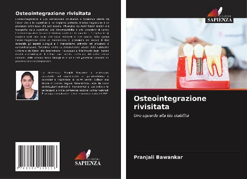 Osteointegrazione rivisitata - Pranjali Bawankar
