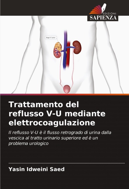 Trattamento del reflusso V-U mediante elettrocoagulazione - Yasin Idweini Saed