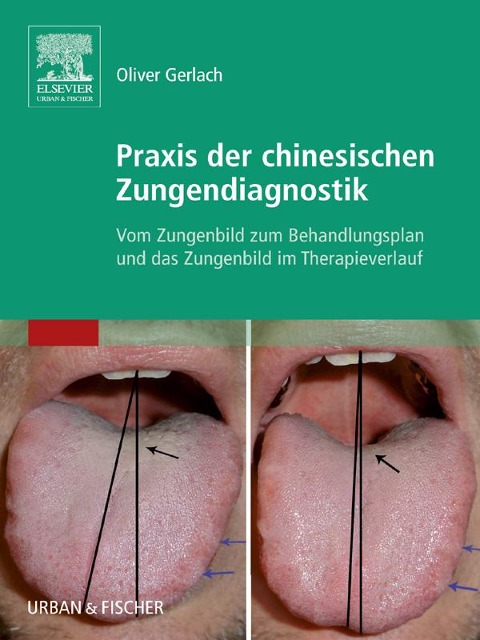 Praxis der chinesischen Zungendiagnostik - Oliver Gerlach