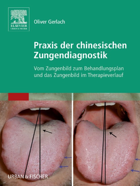 Praxis der chinesischen Zungendiagnostik - Oliver Gerlach