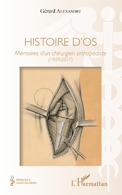 Histoire d'os - Alexandre