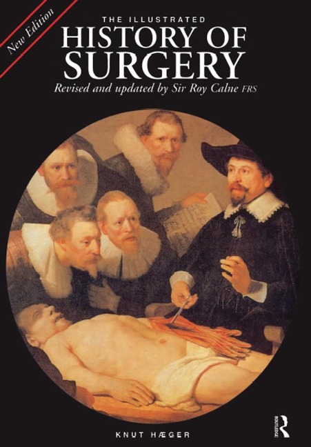 The Illustrated History of Surgery - 