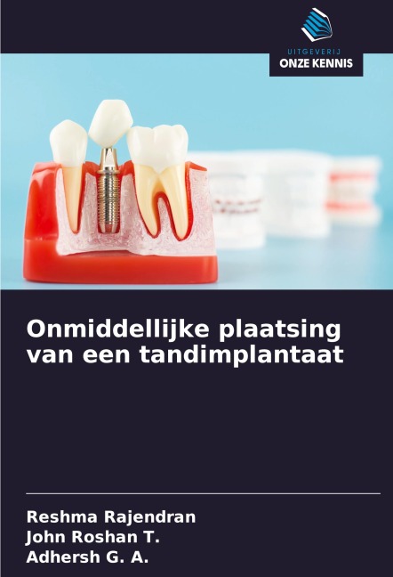 Onmiddellijke plaatsing van een tandimplantaat - Reshma Rajendran, John Roshan T., Adhersh G. A.