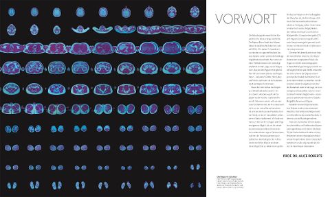 InsideView 2