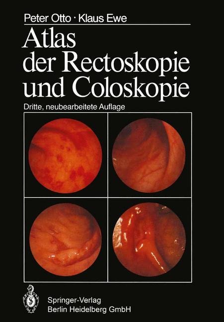 Atlas der Rectoskopie und Coloskopie - K. Ewe, P. Otto