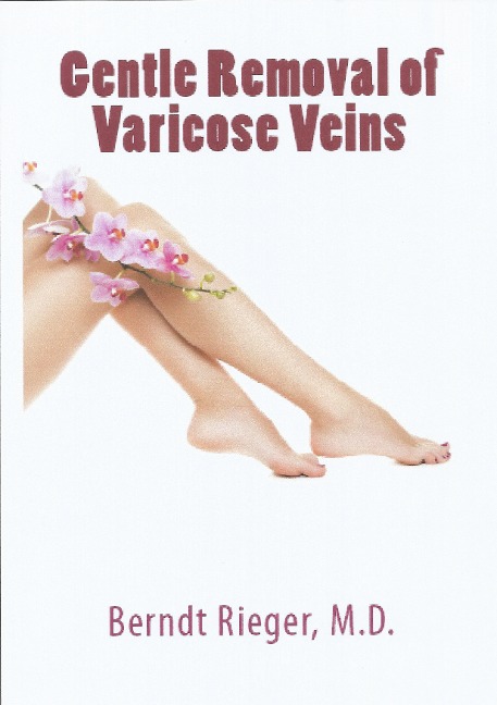 Gentle Removal of Varicose Veins - Berndt Rieger