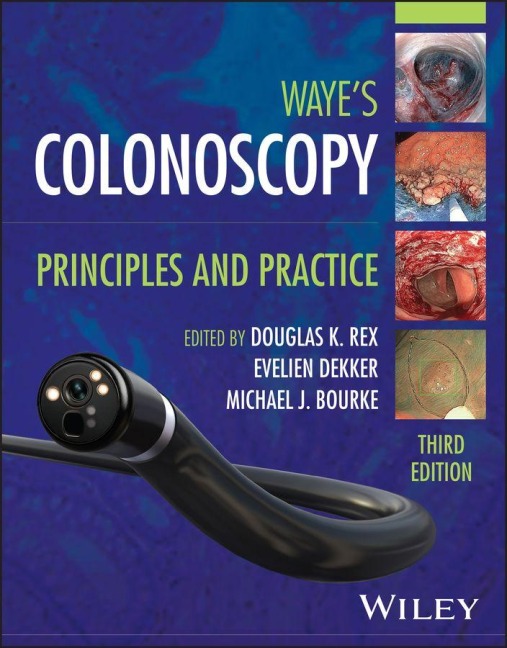 Colonoscopy - 