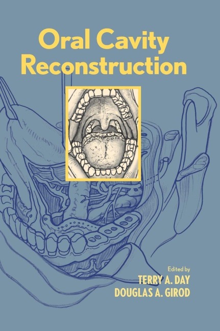 Oral Cavity Reconstruction - 