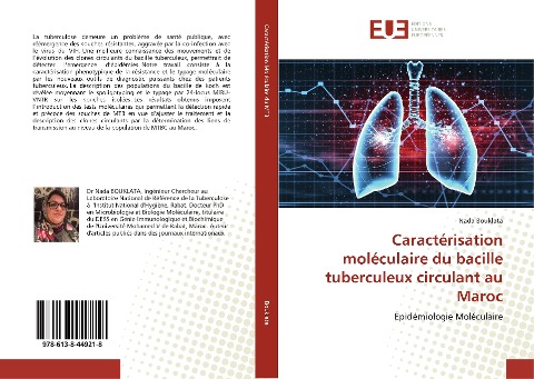 Caractérisation moléculaire du bacille tuberculeux circulant au Maroc - Nada Bouklata