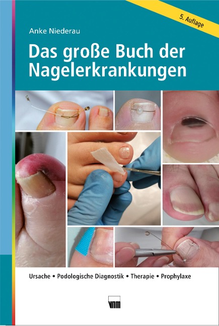 Das große Buch der Nagelerkrankungen - Anke Niederau