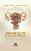 Endometriose Profunda - Guillermo Ignácio Zambrano Pantoja, Victoria Regina da Silva Correia, Rosa Maria Braga Lopes de Moura, Sandrielli Leticia Zambrano Marcondes