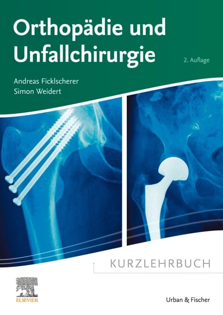 Kurzlehrbuch Orthopädie und Unfallchirurgie - Andreas Ficklscherer, Simon Weidert