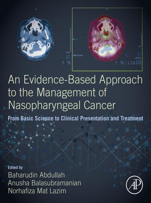 An Evidence-Based Approach to the Management of Nasopharyngeal Cancer - 