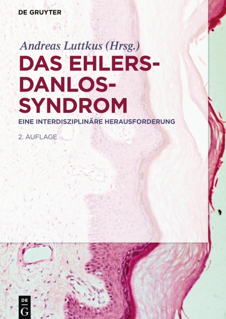 Das Ehlers-Danlos-Syndrom - 