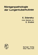 Cover-Bild zum Titel 'Röntgenpathologie der Lungentuberkulose' von 'Erich Zdansky'