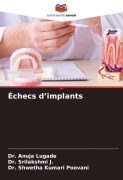 Cover-Bild zum Titel 'Échecs d'implants' von 'Anuja Lugade, Srilakshmi J., Shwetha Kumari Poovani'