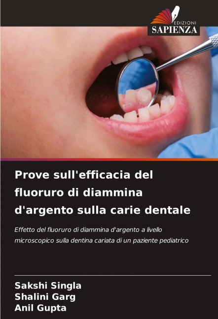 Prove sull'efficacia del fluoruro di diammina d'argento sulla carie dentale - Sakshi Singla, Shalini Garg, Anil Gupta