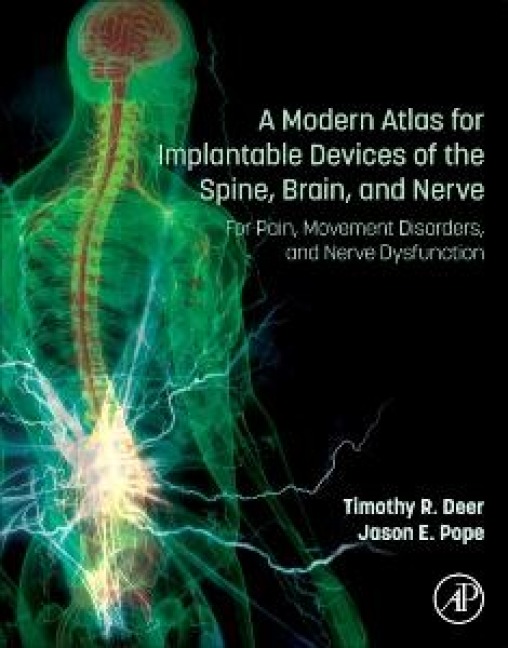 A Modern Atlas for Implantable Devices of the Spine, Brain, and Nerve - 