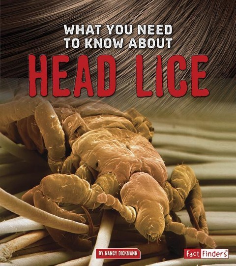 What You Need to Know about Head Lice - Nancy Dickmann