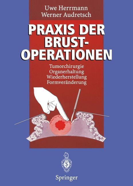 Praxis der Brustoperationen - Werner Audretsch, Uwe Herrmann