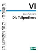 Cover-Bild zum Titel 'Die Teilprothese' von 'Hans H. Caesar, Klaus M. Lehmann'