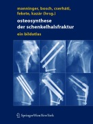 Cover-Bild zum Titel 'Osteosynthese der Schenkelhalsfraktur' von ''