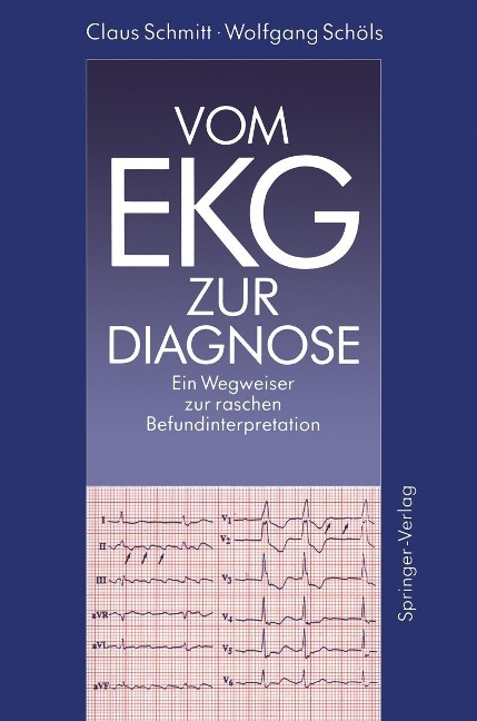 Vom EKG zur Diagnose - Claus Schmitt, Wolfgang Schöls
