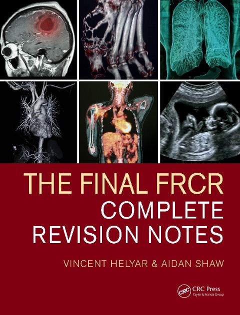 The Final FRCR - Vincent Helyar, Aidan Shaw