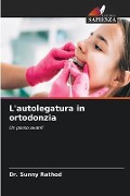 L'autolegatura in ortodonzia - Sunny Rathod