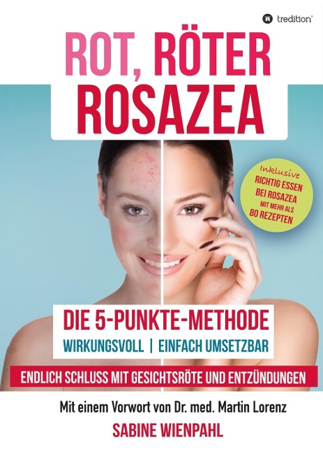 ROT RÖTER ROSAZEA - Sabine Wienpahl