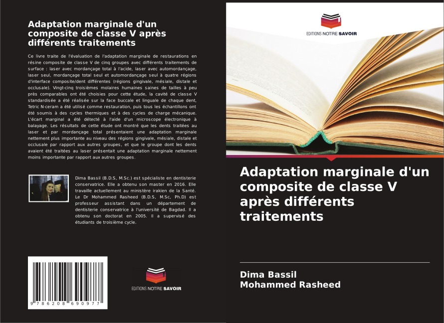 Adaptation marginale d'un composite de classe V après différents traitements - Dima Bassil, Mohammed Rasheed