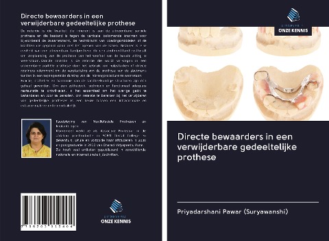 Directe bewaarders in een verwijderbare gedeeltelijke prothese - Priyadarshani Pawar (Suryawanshi)