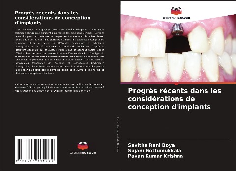 Progrès récents dans les considérations de conception d'implants - Savitha Rani Boya, Sujani Gottumukkala, Pavan Kumar Krishna